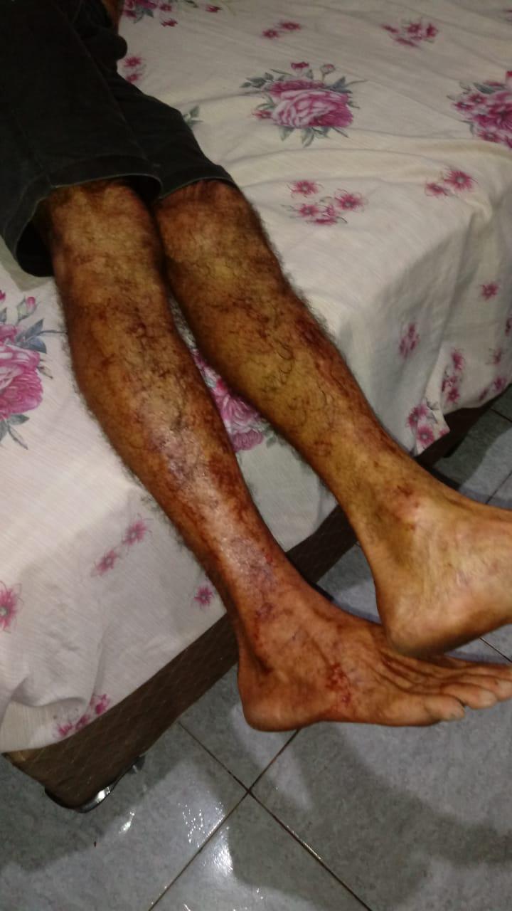 Durante caminhada, homem fica ferido na perna após ser atacado por felino Durante caminhada, homem fica ferido na perna após ser atacado por felino