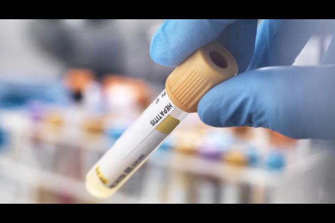 Organização Mundial de Saúde descobre nova cepa da hepatite e confirma 169 casos da doença