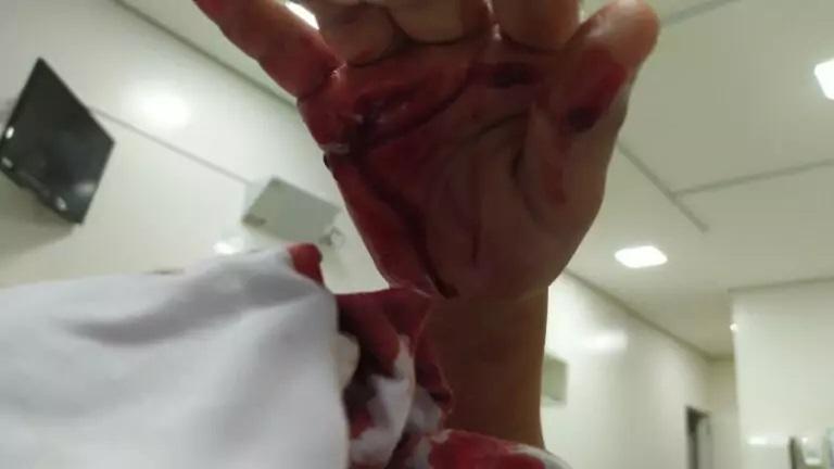 Marido esfaqueia esposa no pescoço e fere filho de 9 anos na mão