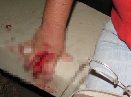 Casal discute em bebedeira e após xingamentos, marido esfaqueia esposa no bairro Santa Luzia 