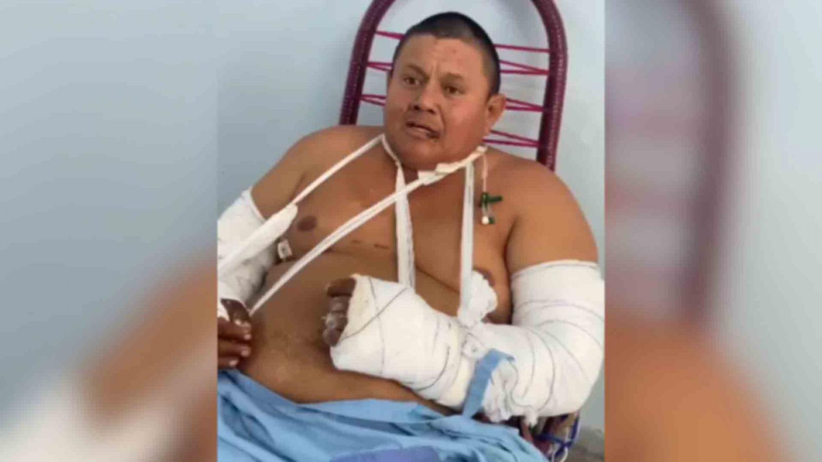 'Mais uma vitória que Deus deu na minha vida', diz peão que sobreviveu a ataque de onça em Corumbá