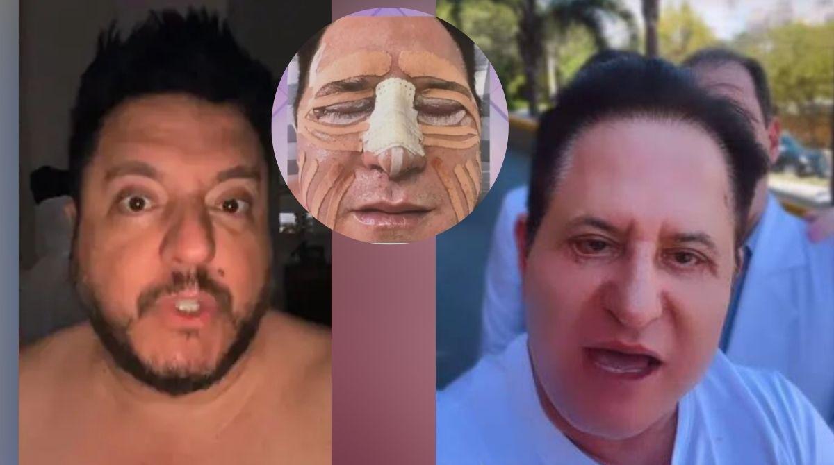 Olho de Marrone não voltou ao lugar certo após cirurgias, revela Bruno após sumiço do parceiro
