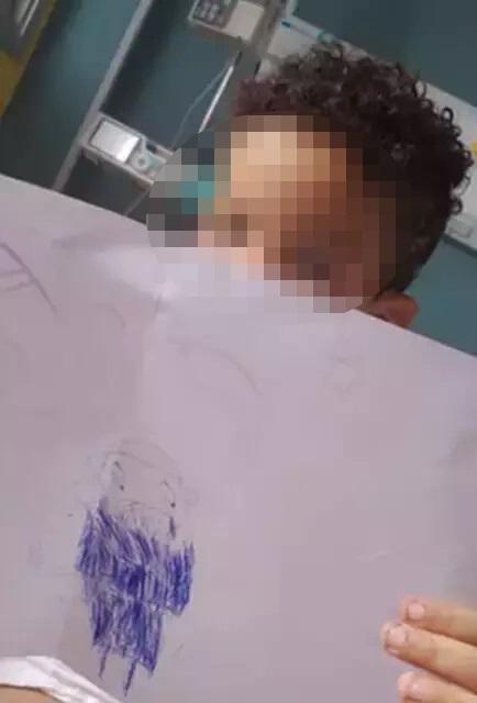 Menino atacado por capivara recebe alta e tratará anemia em casa 