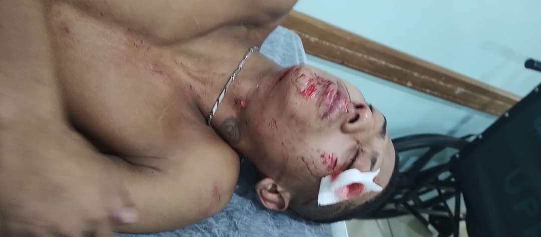 Fuga em acidente: Mãe pede ajuda para encontrar motorista que atropelou seu filho que trabalha como coletor de lixo Fuga em acidente: Mãe pede ajuda para encontrar motorista que atropelou seu filho que trabalha como coletor de lixo