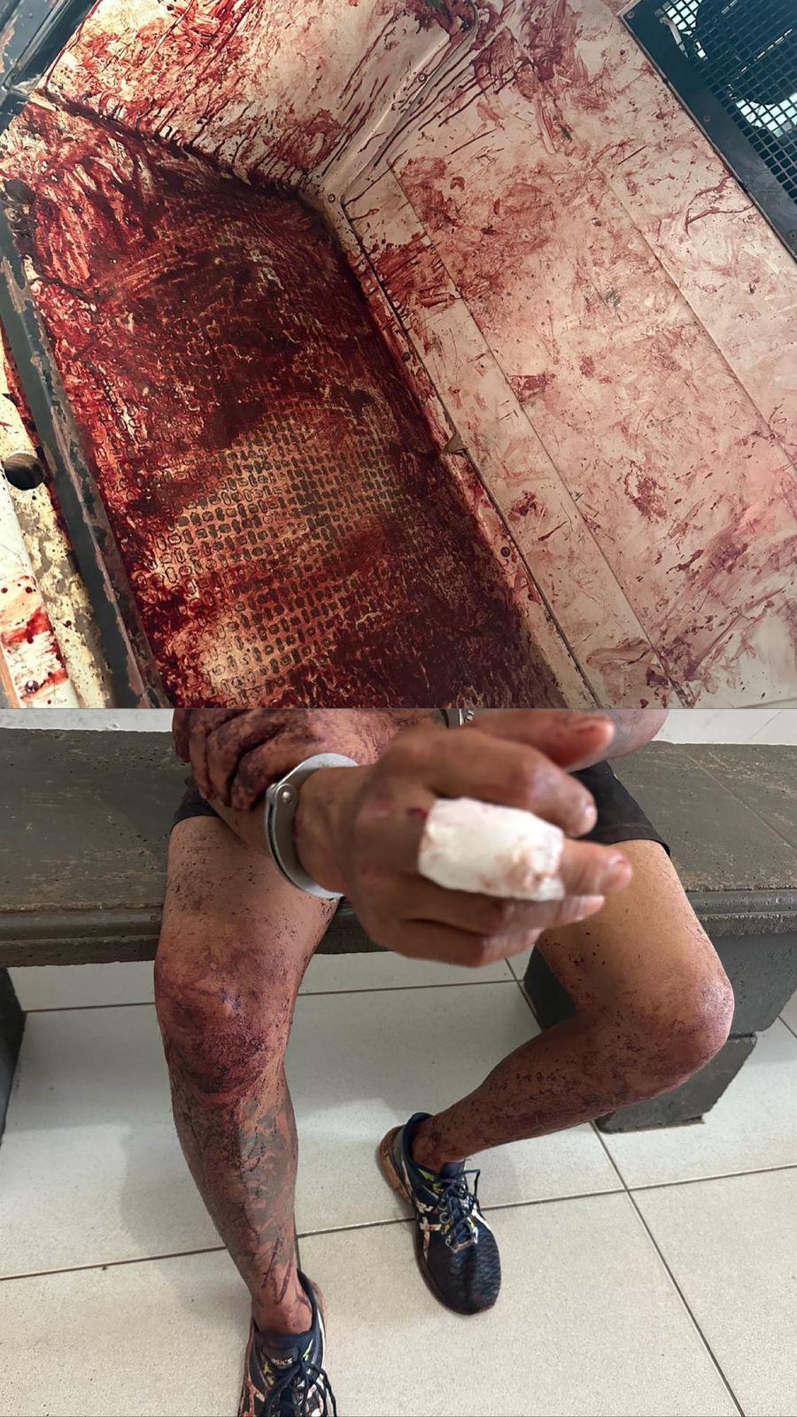 Polícia socorre homem agredido à pauladas pelo sobrinho no “Orestinho 3”