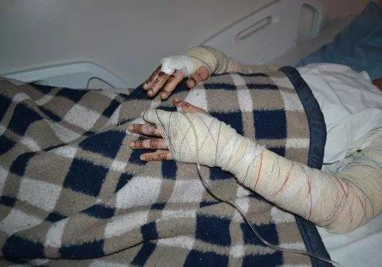 Em Água Clara, namorado tranca porta de casa, joga gasolina e ateia fogo em corpo de mulher Em Água Clara, namorado tranca porta de casa, joga gasolina e ateia fogo em corpo de mulher