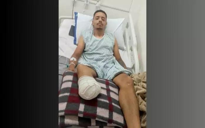 Jovem precisa de ajuda para adquirir prótese depois de sofrer acidente