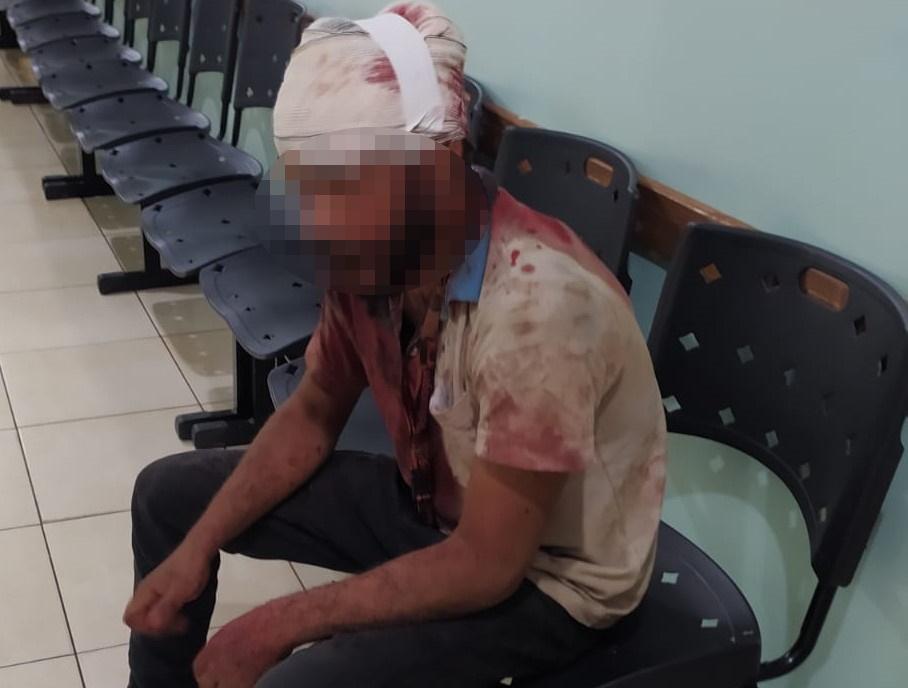  Após bebedeira, dono de lava jato é agredido com golpes de barra de ferro na cabeça que foram desferidos pelo seu sócio 