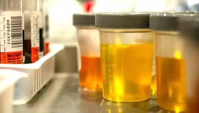 Cliente joga xixi em atendente de laboratório após sistema 