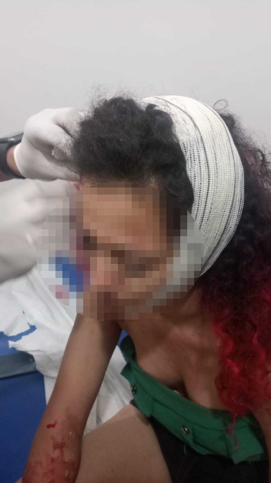 Mulher é agredida e ainda leva “tijolada” na cabeça em Três Lagoas 