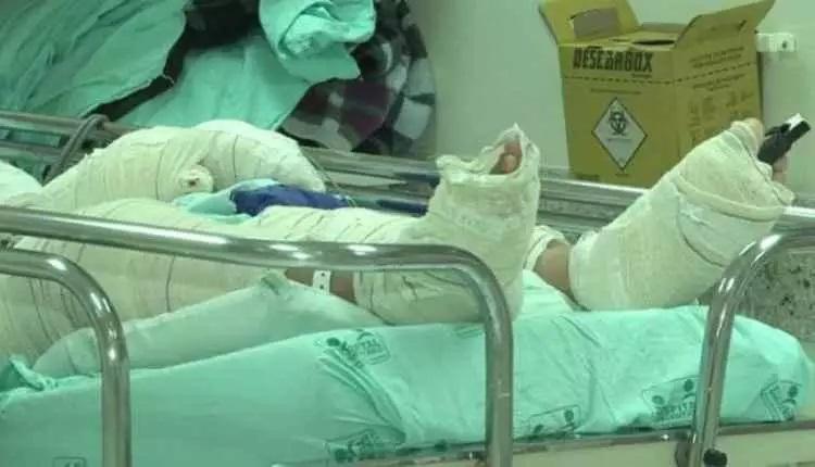 Mulher morre na Santa Casa após ter corpo queimado em acidente com chapa de bife 