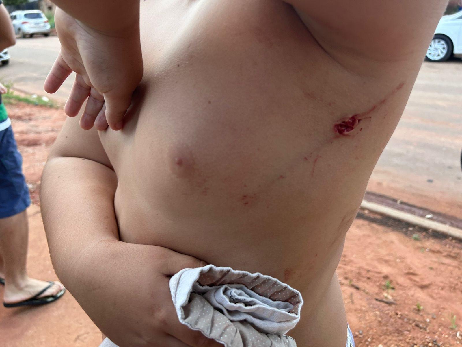 Em "surto", homem fere criança de 10 anos com foice, danifica carro e mobília de residência Em