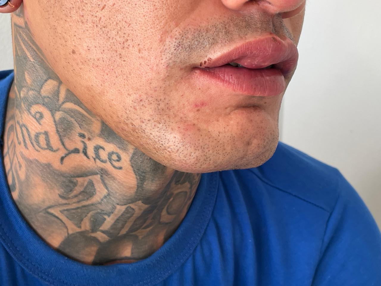 Carpinteiro é agredido e leva coronhadas na cabeça após brigar com vizinho no Jd. Imperial