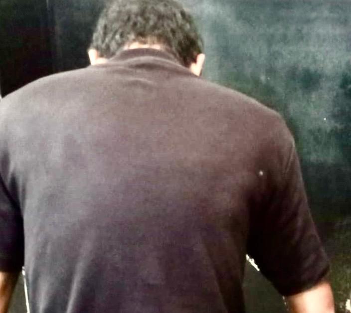 Mulher que apanhou com vara de pescar é brutalmente agredida pelo marido que chegou em casa bêbedo e drogado Mulher que apanhou com vara de pescar é brutalmente agredida pelo marido que chegou em casa bêbedo e drogado