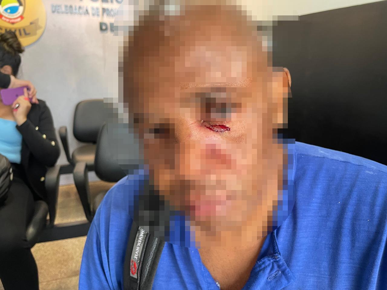 Pai tem mandíbula quebrada e outros ferimentos após não dar dinheiro para o filho comprar drogas 