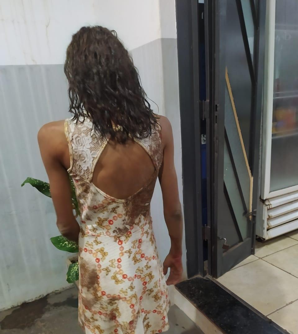 Após jogar bicicleta em esposa, mulher sofre ferimentos; PM e SAMU foram chamados na ocorrência 