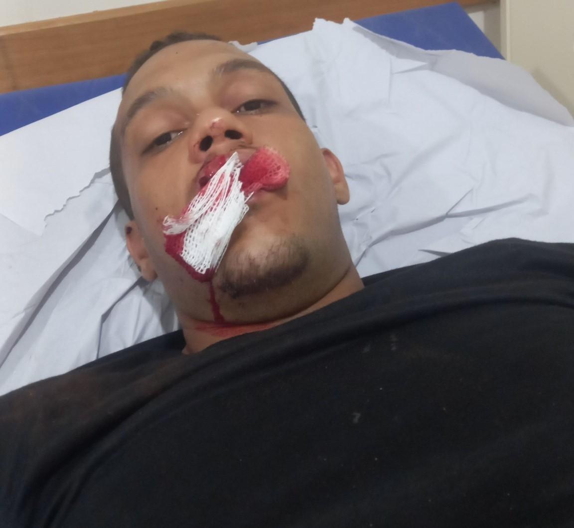 Vídeo viraliza após trabalhador ser brutalmente espancado ao negar que não gostava de “ficar” com outro homem 