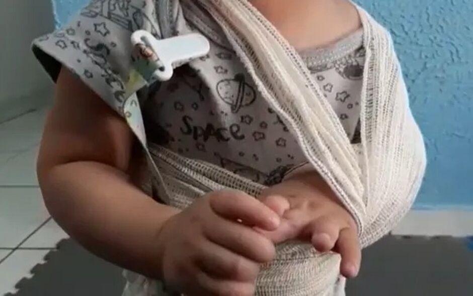 Bebê dá entrada no hospital com braço quebrado e mãe confessa agressão em Sidrolândia Bebê dá entrada no hospital com braço quebrado e mãe confessa agressão em Sidrolândia