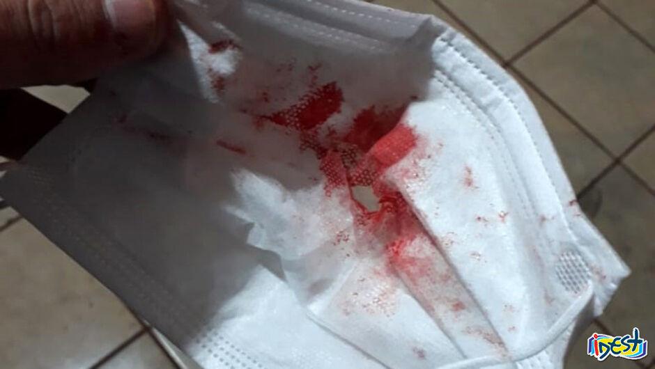 Jovem cospe sangue e morre em unidade de saúde em Dourados