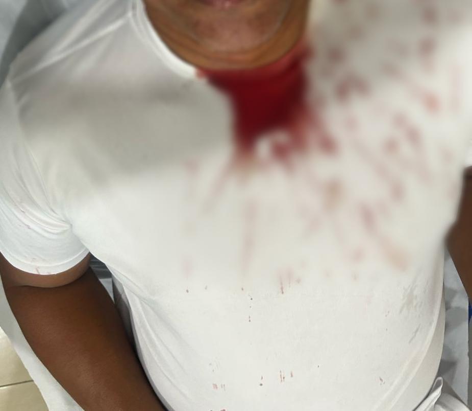 Servidores da UPA “Pedem Socorro”: Além de agressão contra médico, técnico de enfermagem fica ferido após levar tijolada na cabeça Servidores da UPA “Pedem Socorro”: Além de agressão contra médico, técnico de enfermagem fica ferido após levar tijolada na cabeça