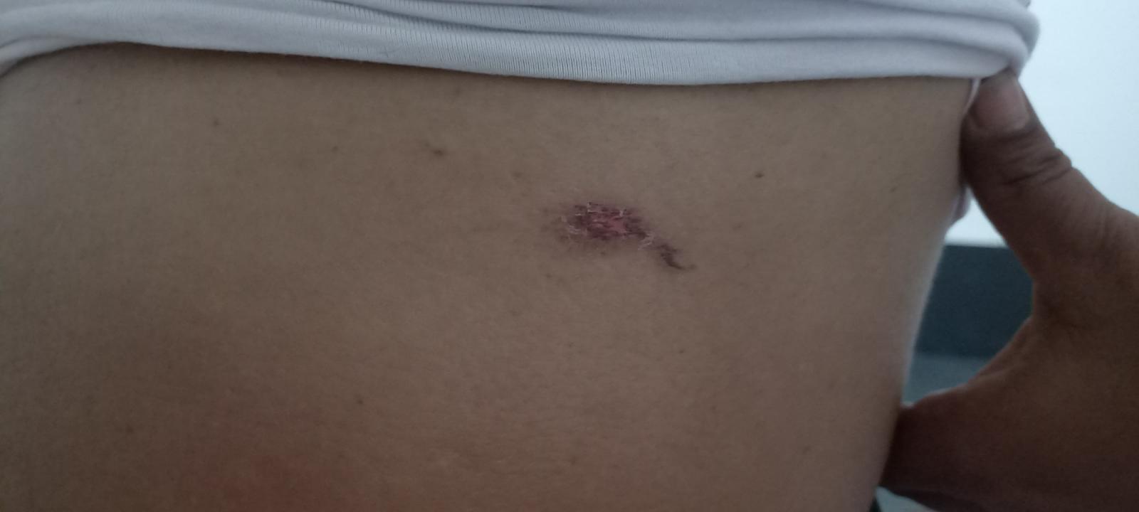 Mulher denuncia marido por cárcere privado e tortura com cigarro em Três Lagoas Mulher denuncia marido por cárcere privado e tortura com cigarro em Três Lagoas