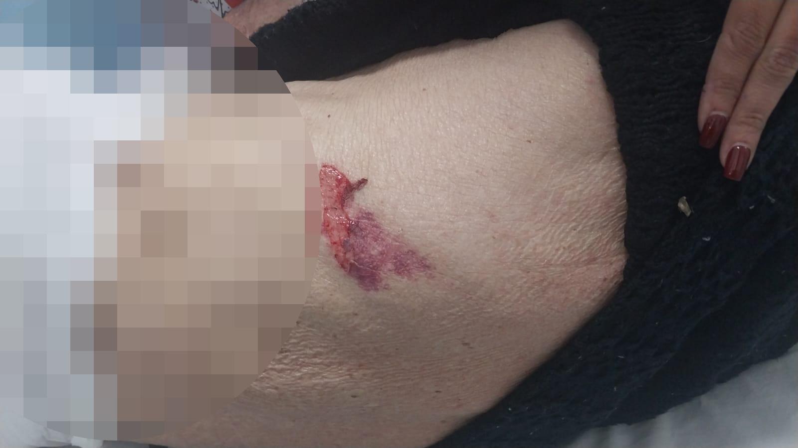 Idoso de 86 anos é resgatado em estado grave após denúncia de maus-tratos em Três Lagoas Idoso de 86 anos é resgatado em estado grave após denúncia de maus-tratos em Três Lagoas