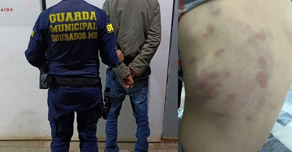 Criança de 3 anos é brutalmente espancada pelo padrasto em Dourados  