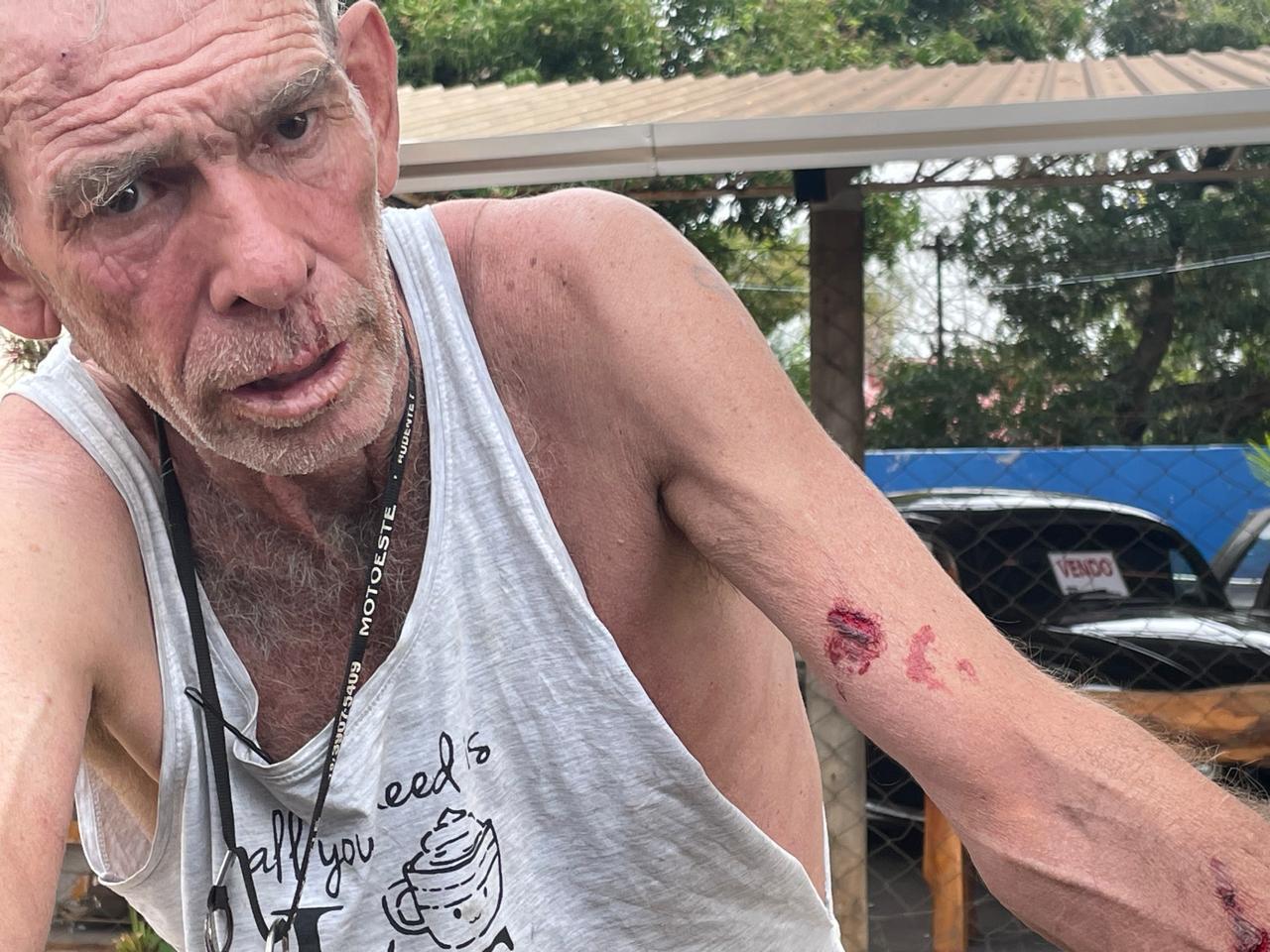  “Dentro do Litro”: Após tomar três “corotes de pinga”, idoso vai na casa do vizinho e agride homem por causa de cachorros em Três Lagoas