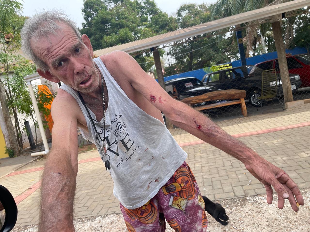 “Dentro do Litro”: Após tomar três “corotes de pinga”, idoso vai na casa do vizinho e agride homem por causa de cachorros em Três Lagoas