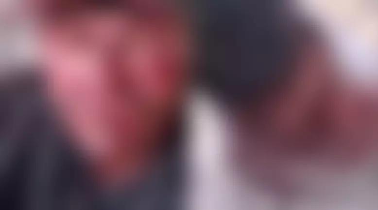 Moradores em situação de rua são brutalmente espancados em praça de Água Clara