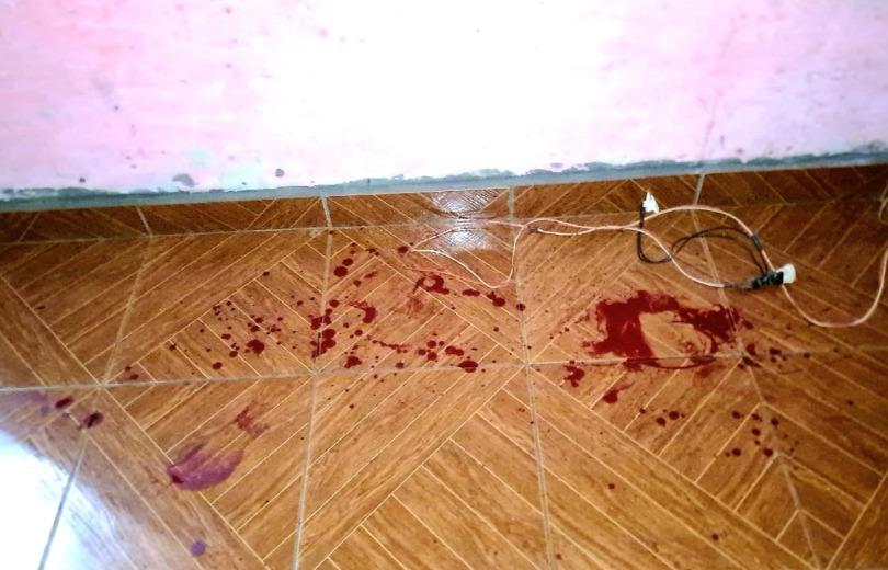 Jovem é baleado no tórax em Chapadão do Sul-MS; suspeito é preso em flagrante Jovem é baleado no tórax em Chapadão do Sul-MS; suspeito é preso em flagrante