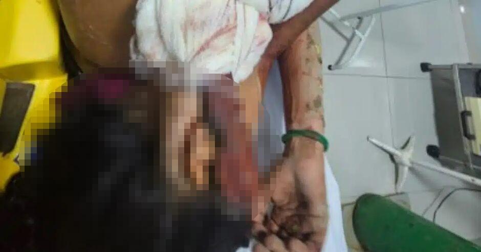 Mulher é esfaqueada no pescoço pela irmã durante briga em Costa Rica-MS