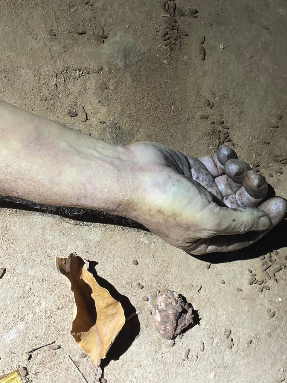 Advogado de 64 anos morre engasgado com pedaço de carne em Três Lagoas Advogado de 64 anos morre engasgado com pedaço de carne em Três Lagoas