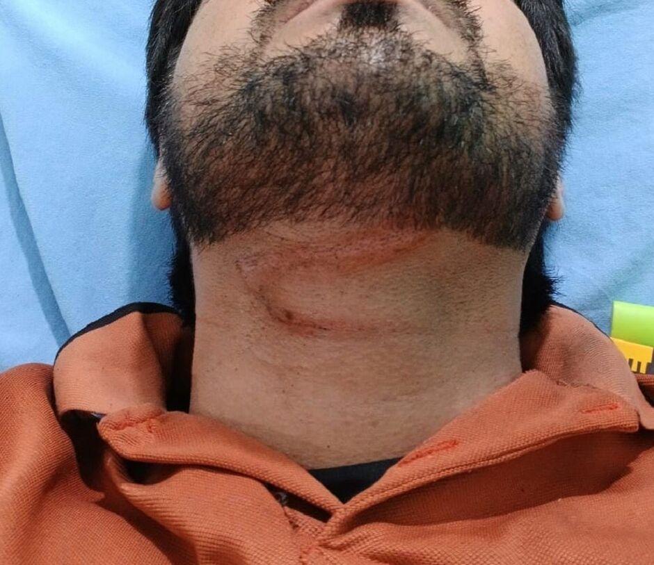 Motoentregador fica ferido ao enroscar em fio de internet em Chapadão do Sul Motoentregador fica ferido ao enroscar em fio de internet em Chapadão do Sul