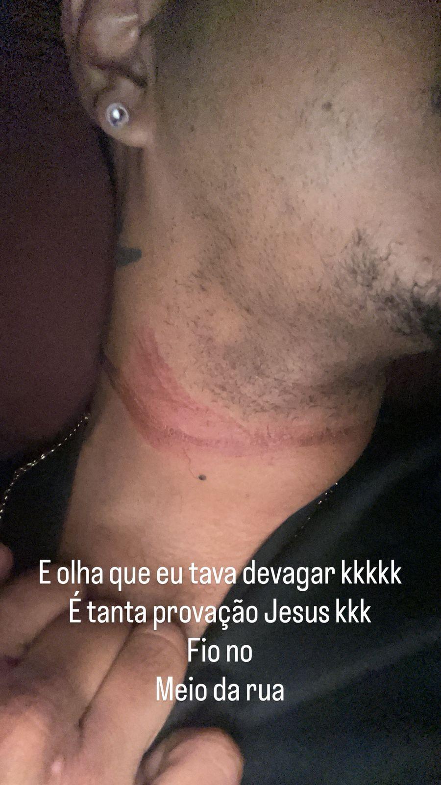 Mais um caso com fios de internet soltos na via deixa motociclista ferido, este já é o 4º incidente em Três Lagoas Mais um caso com fios de internet soltos na via deixa motociclista ferido, este já é o 4º incidente em Três Lagoas