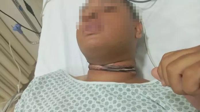 Cabos de internet quase cortam pescoço de jovem em Três Lagoas