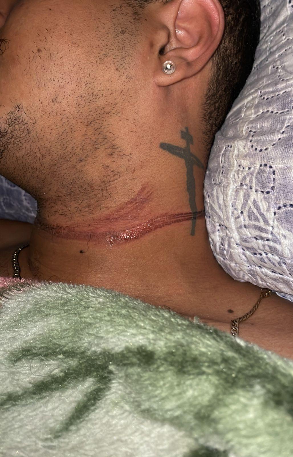 Mais um caso com fios de internet soltos na via deixa motociclista ferido, este já é o 4º incidente em Três Lagoas