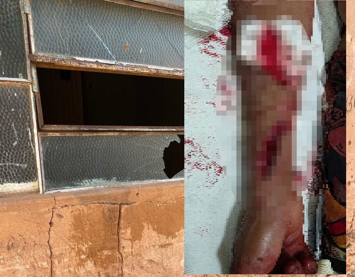 Homem sofre grave ferimento no braço após surto e dar soco em vidro de porta; ele foi socorrido às pressas pelo SAMU de Três Lagoas