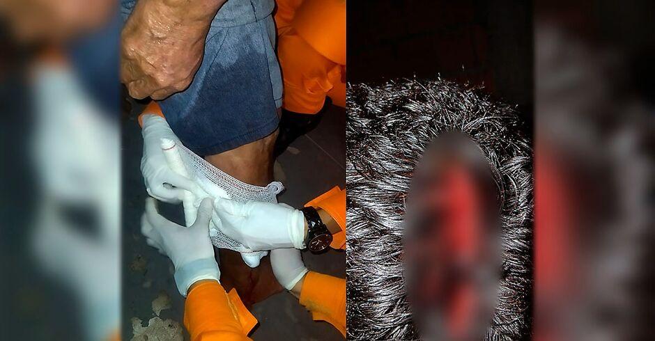 Idoso é atacado por Pitbull e sofre ferimentos graves na cabeça e perna em Corumbá 