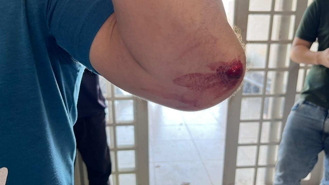 Moradores de rua que possuem passagens policiais por crimes graves agridem técnicos de empresa de internet e acabam presos em Três Lagoas Moradores de rua que possuem passagens policiais por crimes graves agridem técnicos de empresa de internet e acabam presos em Três Lagoas