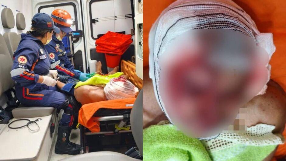 Idoso é atacado por cachorro e sofre múltiplas lacerações no rosto em Aquidauana  