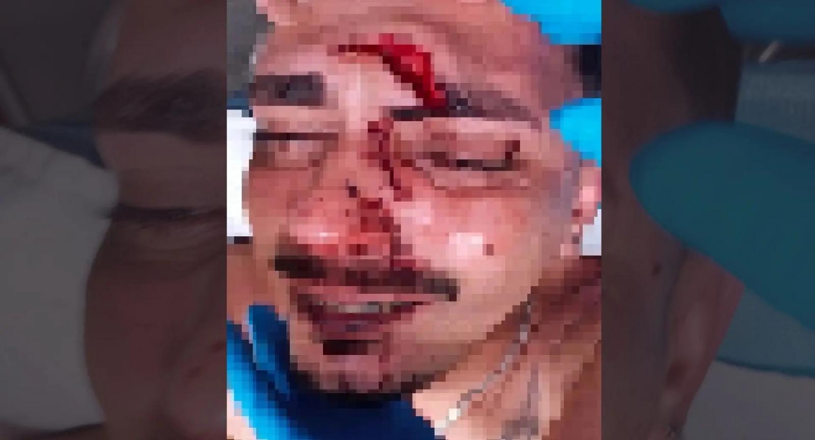 Jovem é atingido por garrafada na cabeça durante a Fejuna e acaba hospitalizado em Nova Andradina