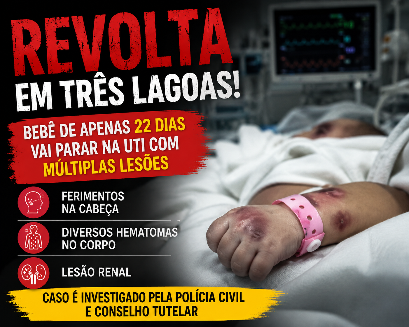 Revolta em Três Lagoas: bebê de apenas 22 dias vai parar na UTI com ferimentos na cabeça, hematomas e lesão renal