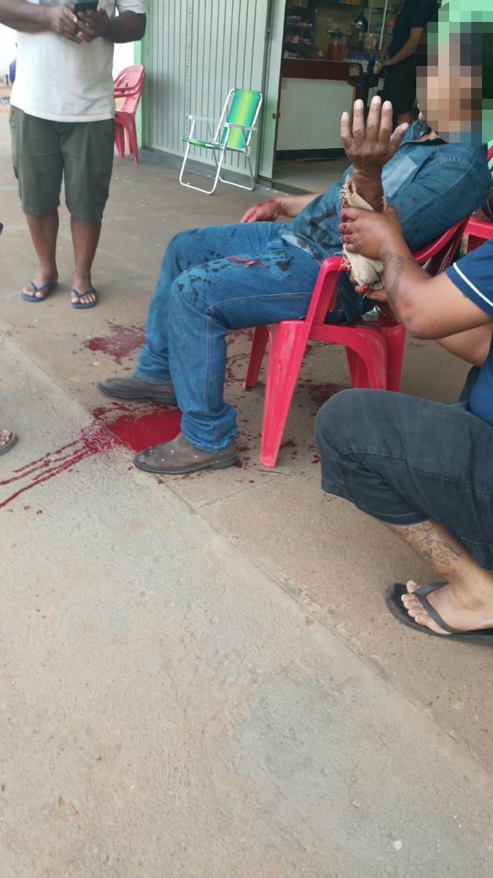 Por pouco não foi degolado: Homem usa os braços para se proteger de linha com cerol e fica gravemente ferido em Três Lagoas Por pouco não foi degolado: Homem usa os braços para se proteger de linha com cerol e fica gravemente ferido em Três Lagoas