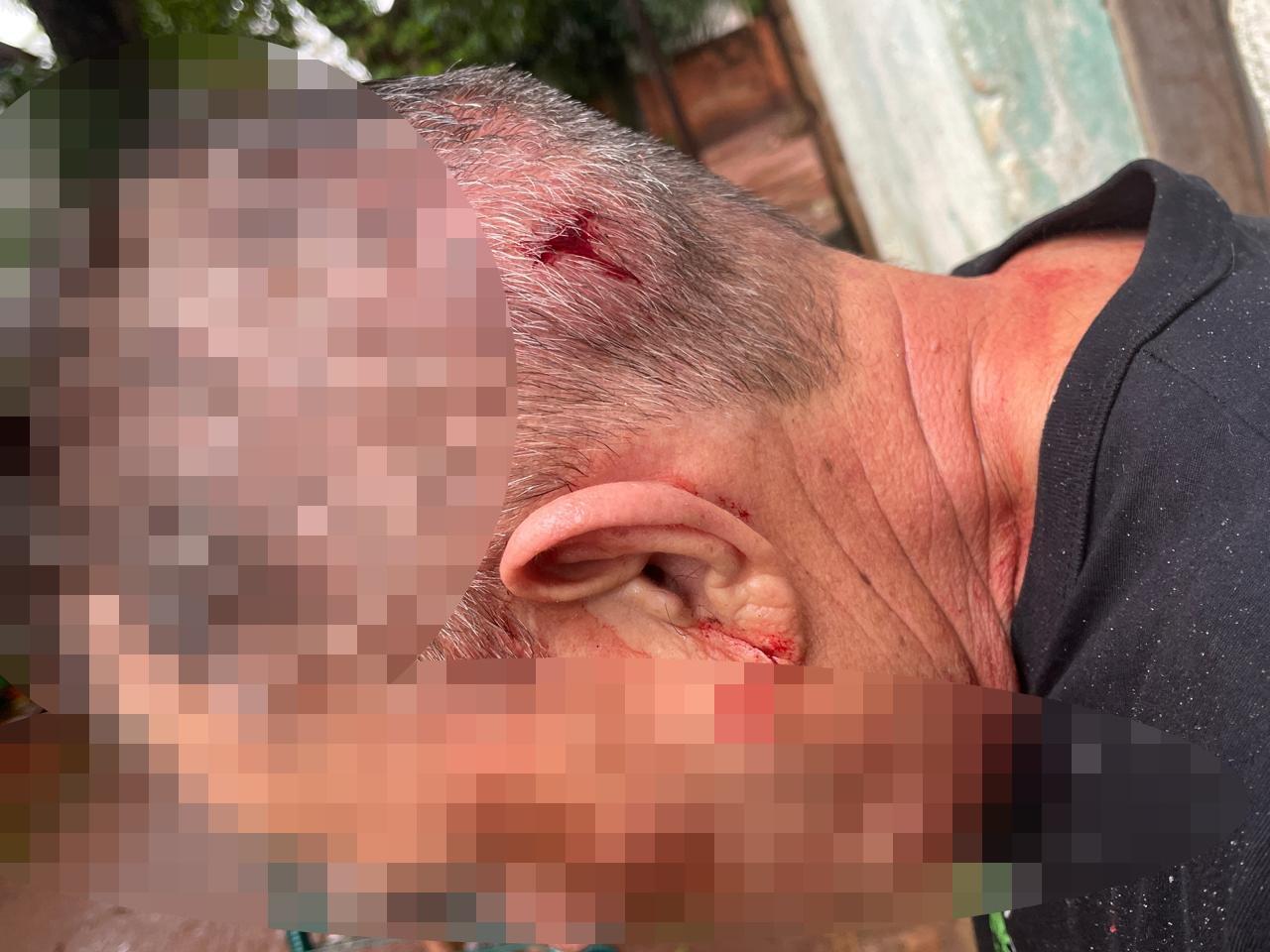 Final dos tempos: Filho de 26 anos agride pai de 65 com vários golpes de pá na cabeça em Três Lagoas Final dos tempos: Filho de 26 anos agride pai de 65 com vários golpes de pá na cabeça em Três Lagoas
