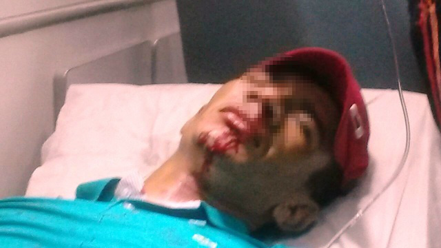 Jovem esfaqueado no Interlagos morre no Hospital Auxiliadora Jovem esfaqueado no Interlagos morre no Hospital Auxiliadora