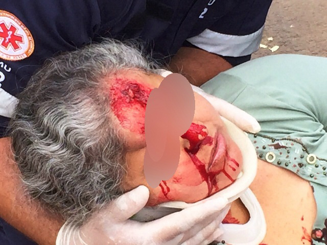 Mulheres ficam feridas em acidente grave no centro de Três Lagoas Mulheres ficam feridas em acidente grave no centro de Três Lagoas