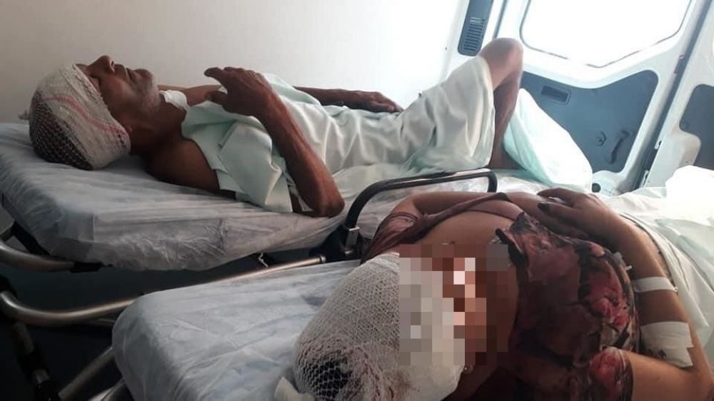 Grávida que sofreu tentativa de estupro teve perfuração no crânio