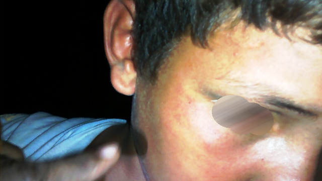 Menino de 10 anos é agredido a capacetadas pelo próprio pai Menino de 10 anos é agredido a capacetadas pelo próprio pai