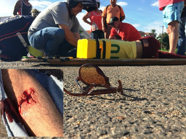 Jovem sofre fratura exposta ao bater em Corolla no bairro Colinos Jovem sofre fratura exposta ao bater em Corolla no bairro Colinos